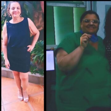 Antes e Depois Cirurgia Bariátrica Tania